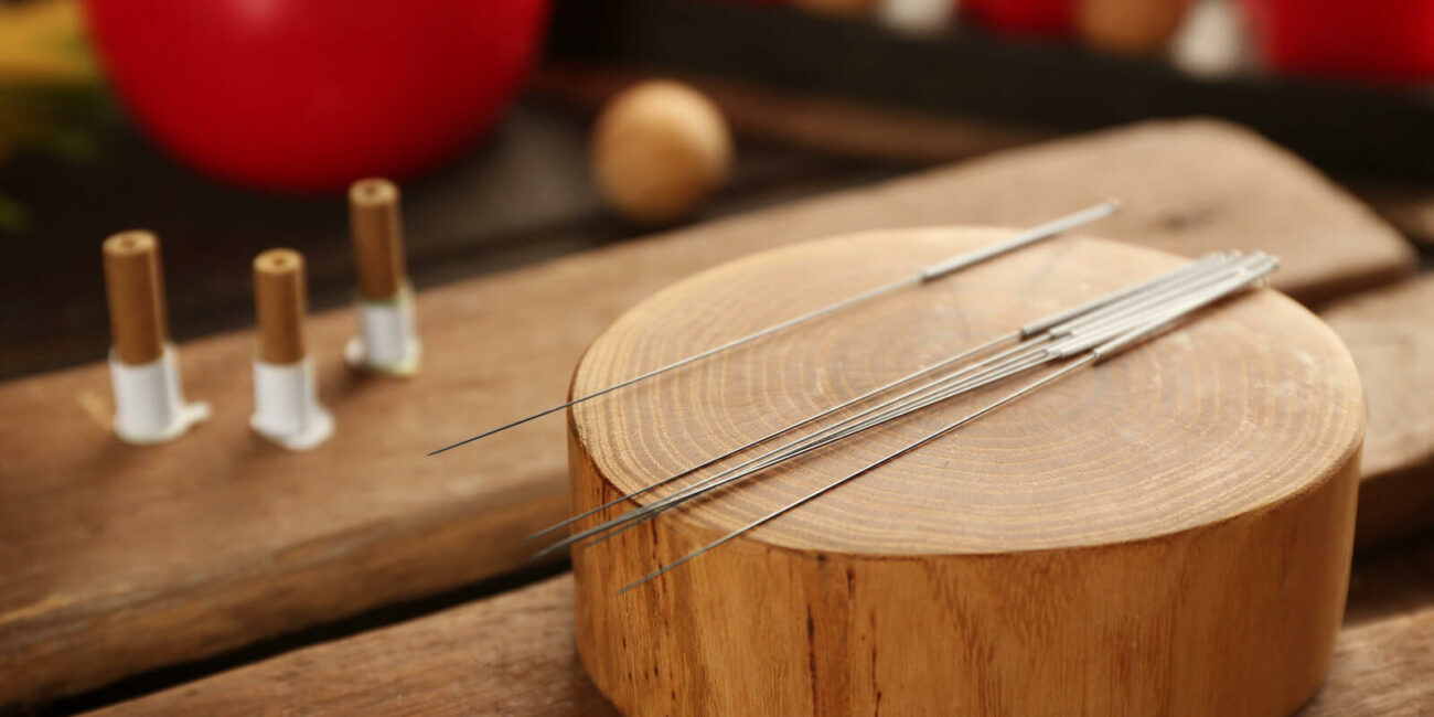acupuncture
