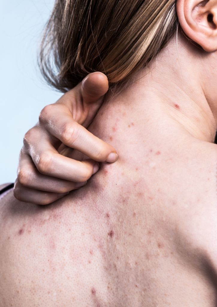 pb peau problème de peau