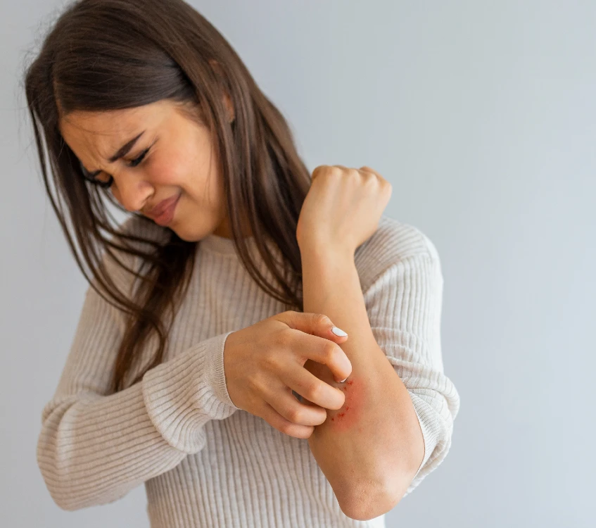 Acupuncture et problème de peau