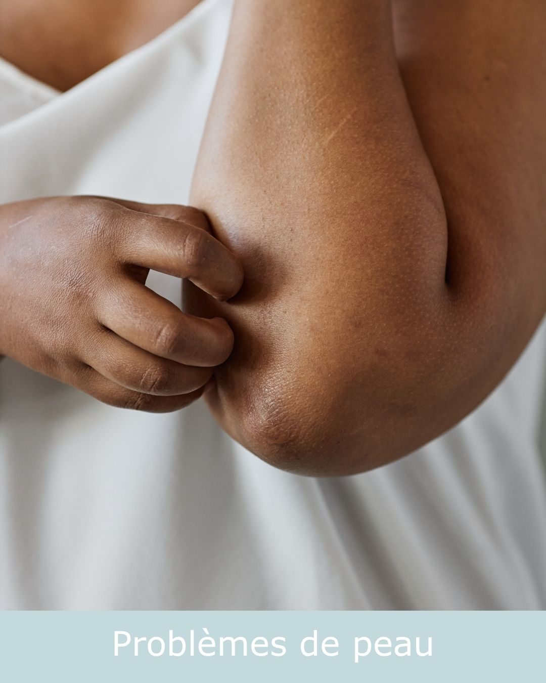 pb de peau