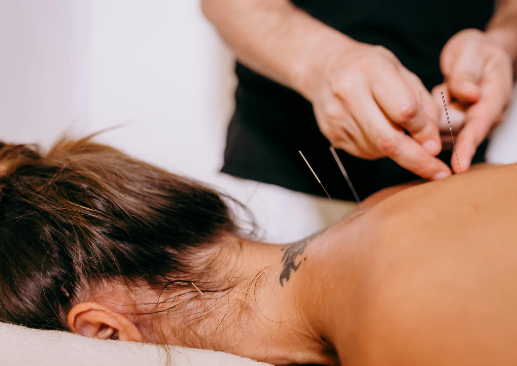 acupuncture enfant